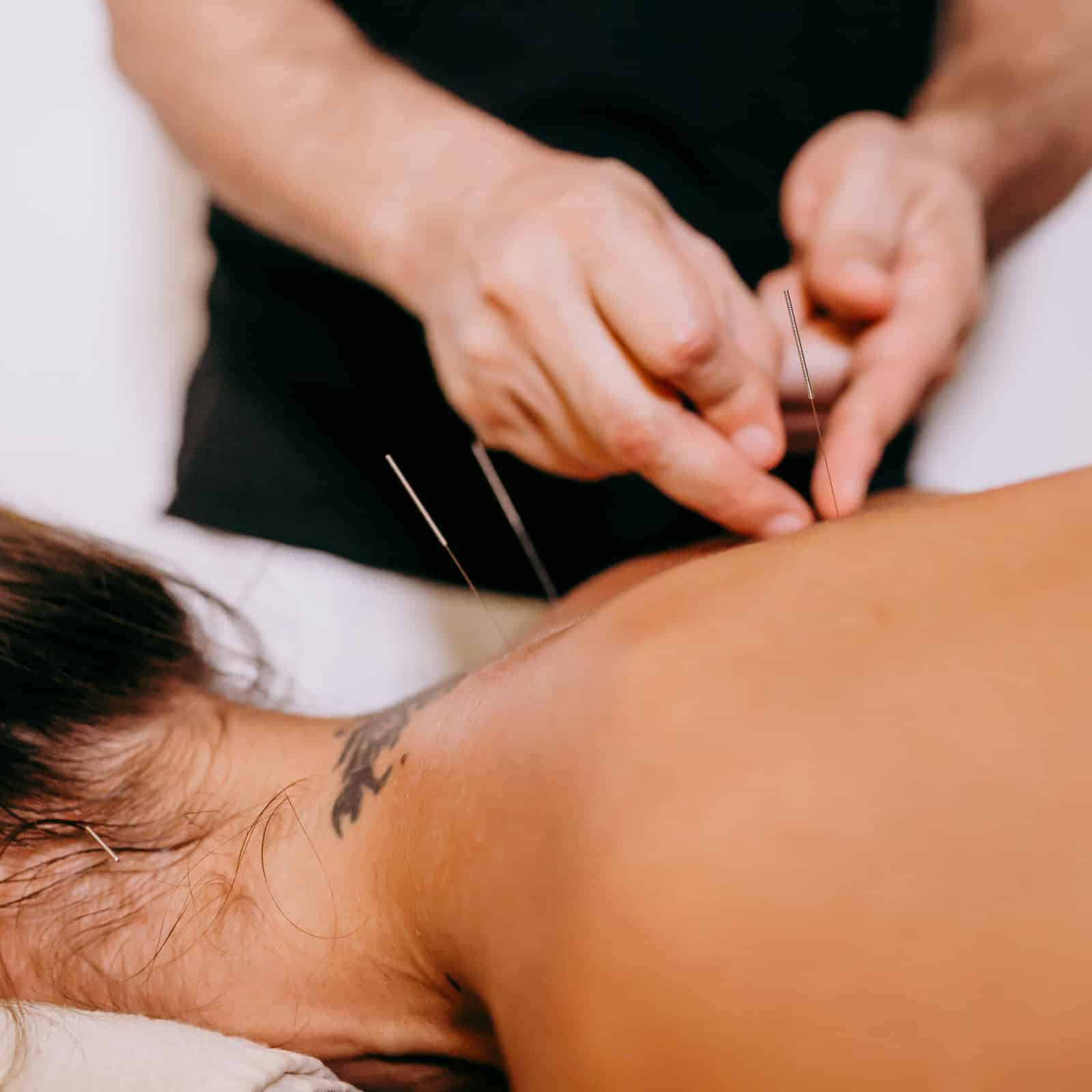 Akupunktūra Vilnelės klinikose – sveikata ir pusiausvyros atstatymas