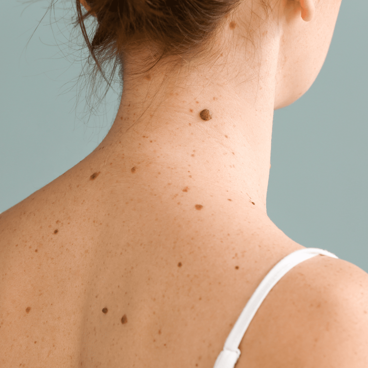 Dermatologija
